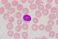 Lymphocyte