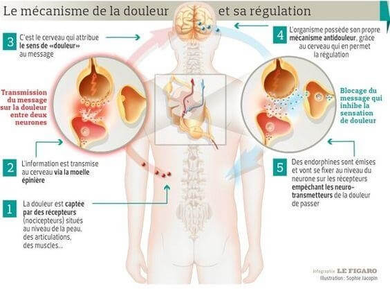 gestion de l'anxiété - Le mécanisme de la douleur et sa régulation