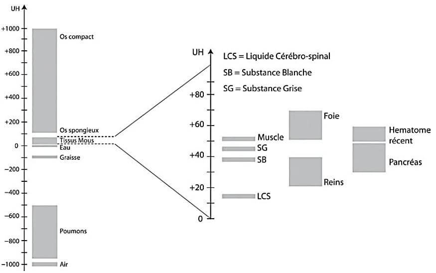 Scanner simulateur - Echelle de Hounsfield
