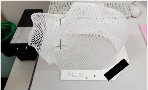 La technique 5 champs - Masque thermoformé 3 points