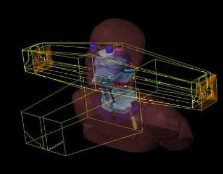 La technique 5 champs - Illustration de l’ensemble des faisceaux de la technique classique