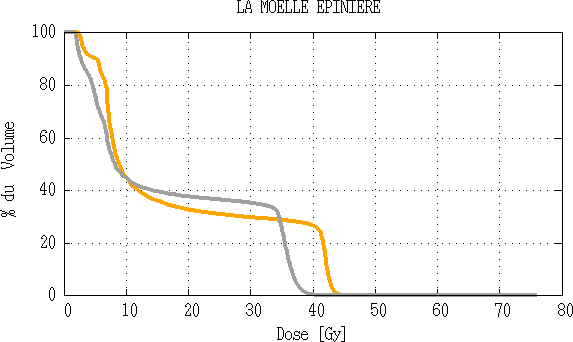 Comparaison d’histogramme dose volume de la moelle épinière