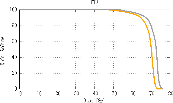 Comparaison d’histogramme dose volume du PTV70