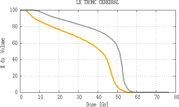 Comparaison d’histogramme dose volume du tronc cérébral
