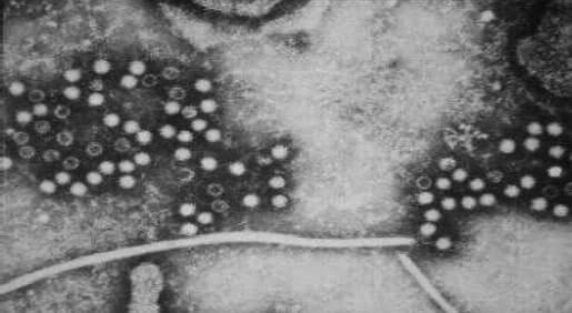 Virus observation microscopique