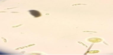 observation microscopique des micro-algues GX40 Genres Eutonia, Diatoma, Cocconies, Asterococcus
