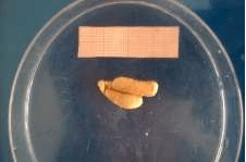 Aperçu de gonades au stade ovocytaire IV