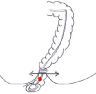 Schéma des dissimulations possibles dans le corps humain, conception Julien Magana, 2022