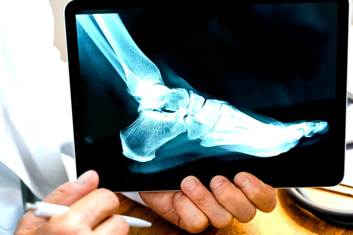 Stratégies innovantes pour le traitement du trachome au Cameroun