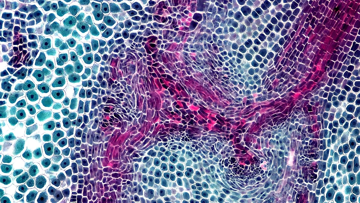 Applications pratiques des thérapies innovantes en médecine oro-faciale