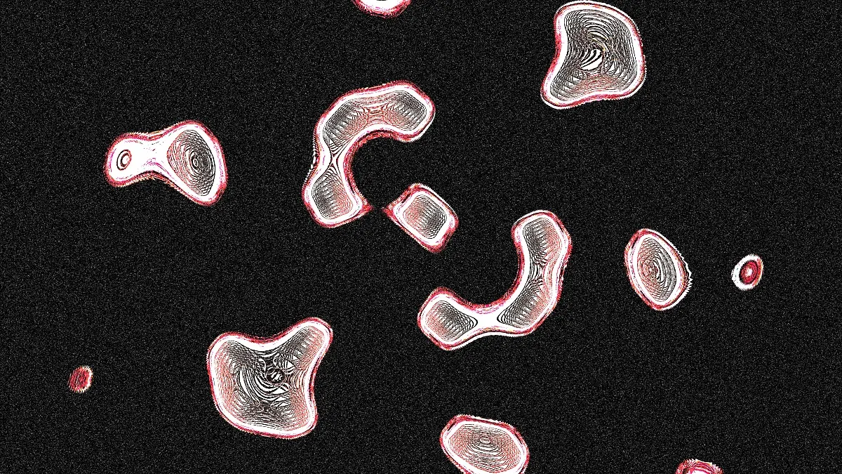 Étude de cas : CSM dans la sphère oro-faciale